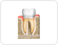 cross section of a molar [1]